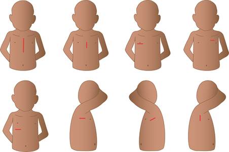 Cardiologia pediatrica2.jpeg