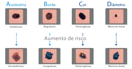 evolucao.png