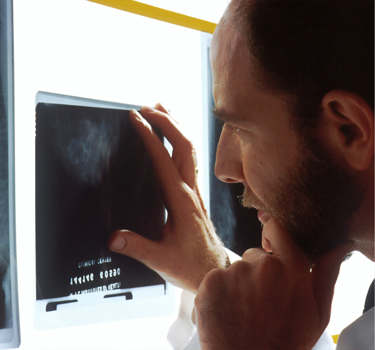 médico olhando para um exame de raio-x sobre uma luz branca