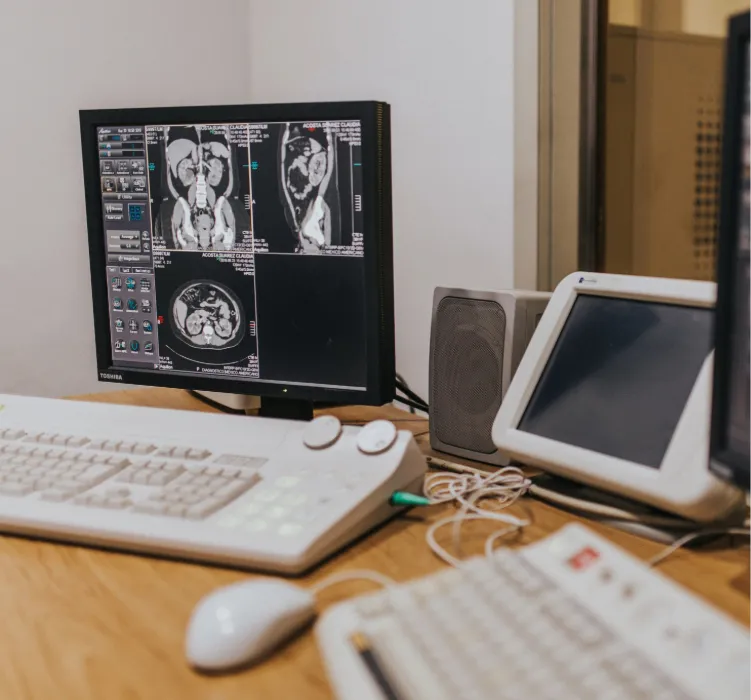 computadores com imagens de uma ressonância abdominal de um paciente